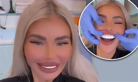 chloe sims teeth|Chloe Sims reveals her brand new Hollywood smile .